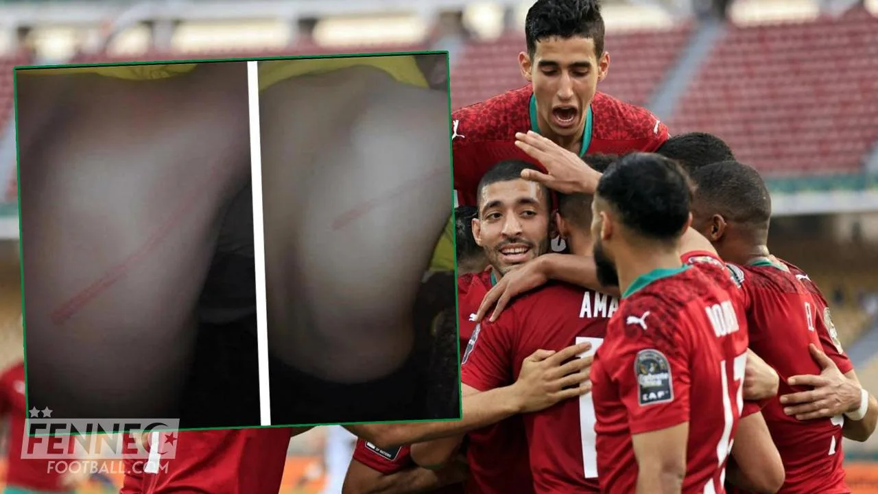 Incroyable ! Un joueur de l'équipe du Maroc violemment agressé par un supporter