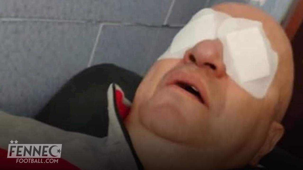 Mustapha Maza sort du silence après une terrible attaque à l’acide !